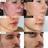 Ivo skin - Intensive Cika Repair Cream